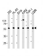 YY1 Polyclonal Antibody