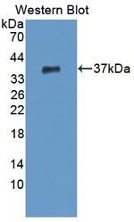 CPSF1 Polyclonal Antibody