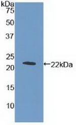 c-Mpl Polyclonal Antibody