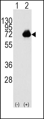 ACOX1 Polyclonal Antibody
