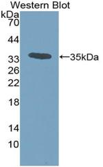 CCL7 (MCP3) Polyclonal Antibody