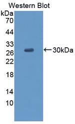 CCDC3 Polyclonal Antibody