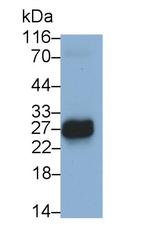 CCDC3 Antibody in Western Blot (WB)