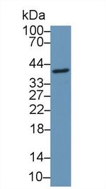 CCDC3 Antibody in Western Blot (WB)