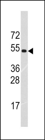RNF36 Polyclonal Antibody