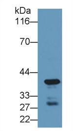 Carboxypeptidase A4 Polyclonal Antibody