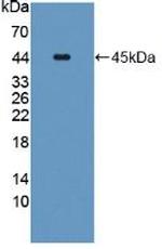 Carboxypeptidase A4 Antibody in Western Blot (WB)