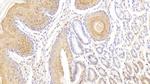 cGAS Polyclonal Antibody