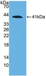 Complement C4a Antibody in Western Blot (WB)