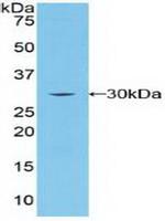 BRCA2 Polyclonal Antibody
