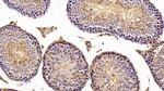 BCMO1 Antibody in Immunohistochemistry (Paraffin) (IHC (P))