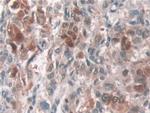 ATP7B Antibody in Immunohistochemistry (Paraffin) (IHC (P))