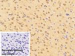 ATP7B Polyclonal Antibody
