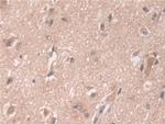 ATP7B Antibody in Immunohistochemistry (Paraffin) (IHC (P))