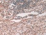 ATP7B Antibody in Immunohistochemistry (Paraffin) (IHC (P))