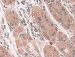 ATP7B Antibody in Immunohistochemistry (Paraffin) (IHC (P))