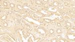 SERPINA3 Polyclonal Antibody