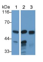 Amylase alpha Antibody in Western Blot (WB)