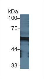 Amylase alpha Antibody in Western Blot (WB)