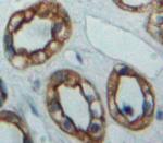 Adenylate Cyclase 5 Polyclonal Antibody