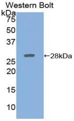 Adenylate Cyclase 5 Antibody in Western Blot (WB)