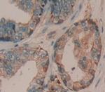 ADAMTS16 Polyclonal Antibody