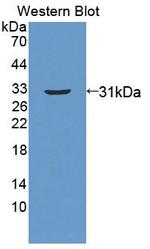 ABCC11 Polyclonal Antibody