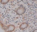 ABCA12 Polyclonal Antibody