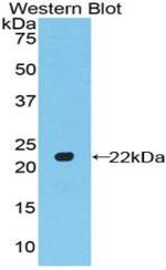 A26C2 Polyclonal Antibody