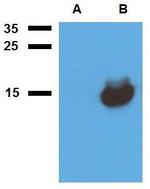 Mycobacterium tuberculosis Acr1 Antibody in Western Blot (WB)