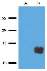 Mycobacterium tuberculosis Tb10.3 Polyclonal Antibody