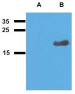 Mycobacterium tuberculosis Acr2 Polyclonal Antibody