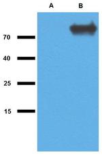 Mycobacterium tuberculosis GlcB Polyclonal Antibody