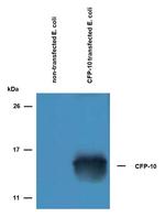 Mycobacterium tuberculosis CFP-10 Polyclonal Antibody