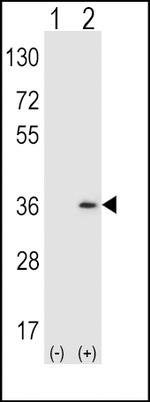 SULT1A1 Polyclonal Antibody
