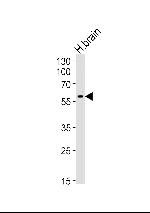 HERV Antibody in Western Blot (WB)