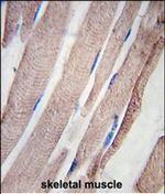 PHPT1 Polyclonal Antibody