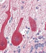 Aldolase C Antibody in Immunohistochemistry (Paraffin) (IHC (P))