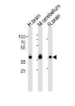 Aldolase C Antibody in Western Blot (WB)