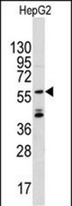 ANGEL2 Antibody in Western Blot (WB)