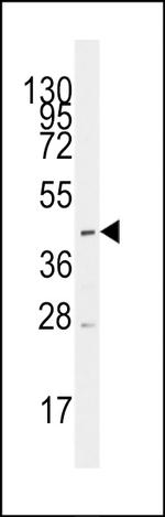 MCT1 Polyclonal Antibody