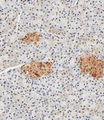 NSE Polyclonal Antibody