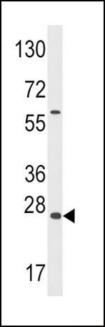 GADD45A Antibody in Western Blot (WB)