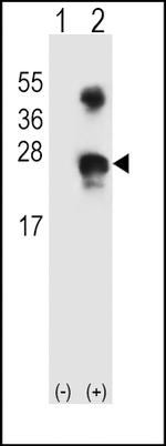 GADD45A Antibody in Western Blot (WB)