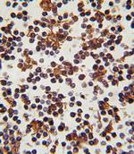 FOXP3 Antibody in Immunohistochemistry (Paraffin) (IHC (P))