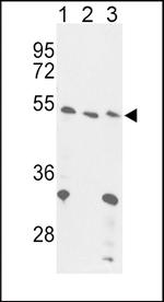 FOXP3 Antibody in Western Blot (WB)