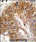 PSMD11 Polyclonal Antibody
