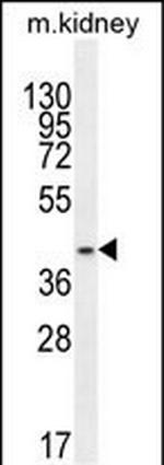 PSMD11 Antibody in Western Blot (WB)