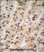 PCNA Antibody in Immunohistochemistry (Paraffin) (IHC (P))
