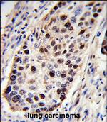 PCNA Antibody in Immunohistochemistry (Paraffin) (IHC (P))